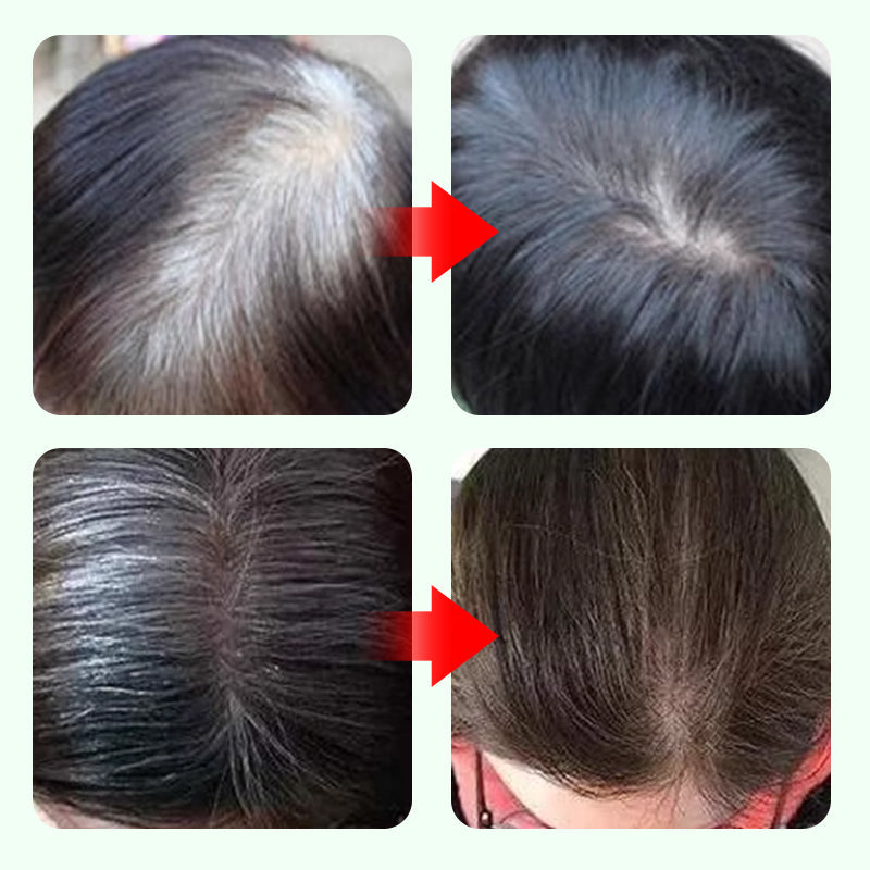 Stylo Anti-Racines 10 Secondes - Jeunesse Instantanée en un Clic