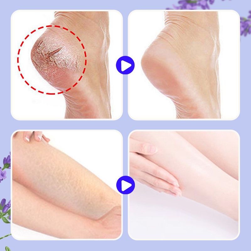 Baume réparateur nourrissant pour les pieds anti-crevasses