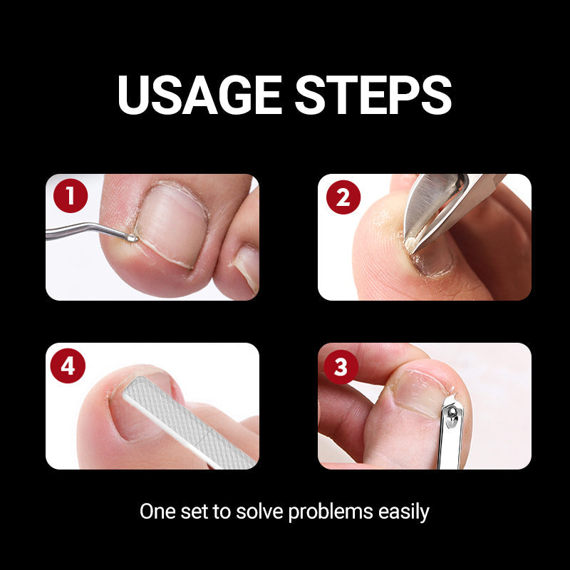 🔥Vente à chaud 50 % de réduction🔥Coupe-ongles professionnels pour ongles incarnés 7 pièces