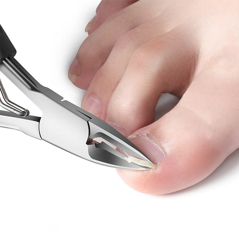 🔥Vente à chaud 50 % de réduction🔥Coupe-ongles professionnels pour ongles incarnés 7 pièces