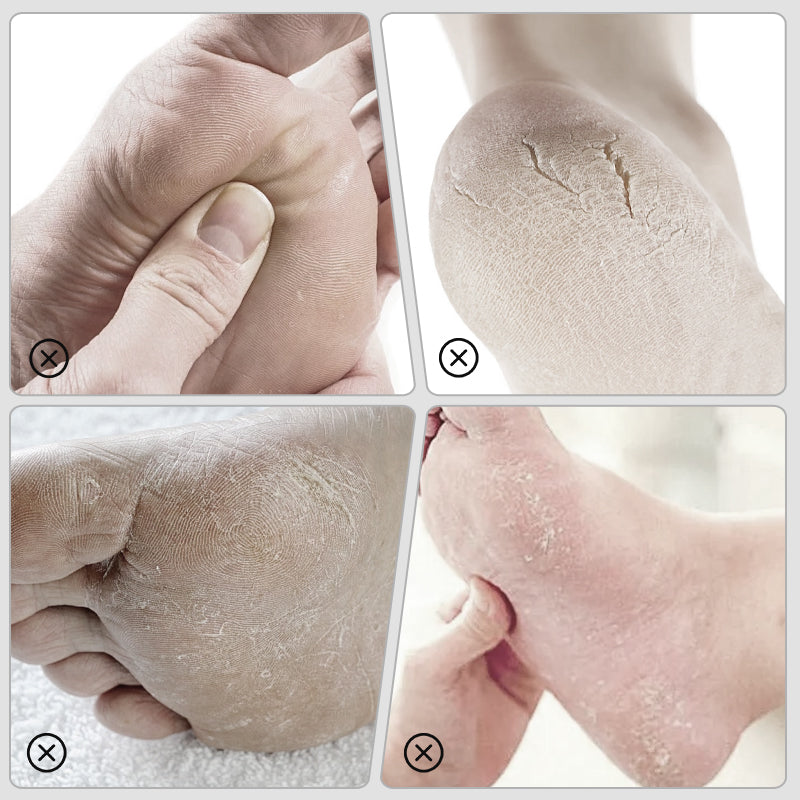 Lime manuelle pour pieds pour éliminer les peaux mortes et les callosités