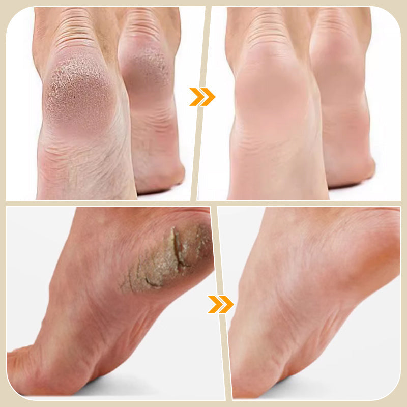 Lime manuelle pour pieds pour éliminer les peaux mortes et les callosités